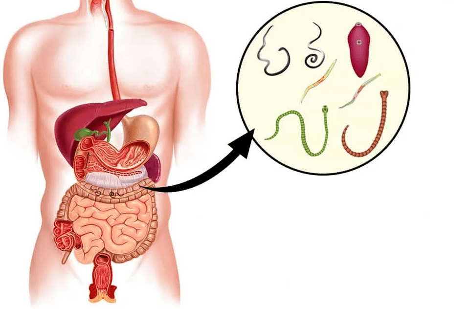 Helmintos e vermes no tracto gastrointestinal