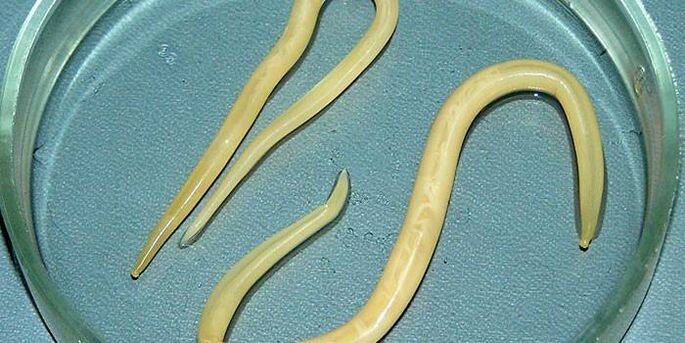 Vermes redondos humanos nunha placa de Petri - parasitan nas paredes do intestino delgado
