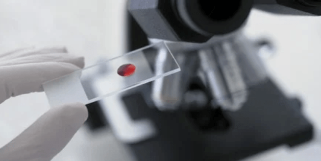 Proba de sangue