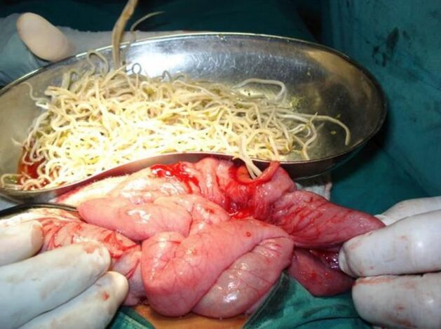 Parasitos intestinais